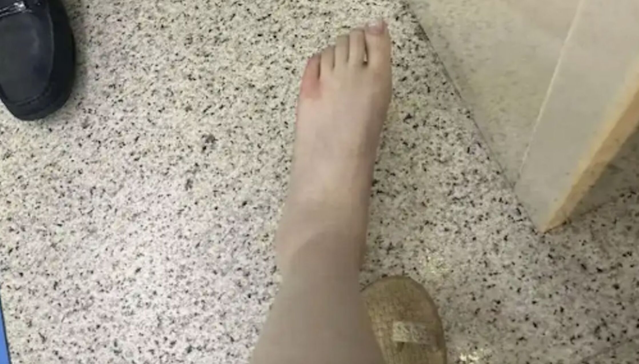 ▲女子在蘇州五星酒店用餐時，被4公分長的蜈蚣咬傷腳。（圖／翻攝微博）