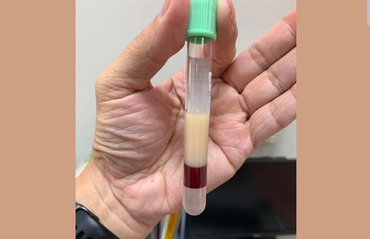 ▲▼             。（圖／翻攝自Facebook／Icu醫生陳志金）