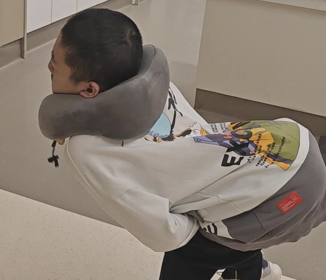 ▲山東「折疊男孩」姜延琛終於完成四次手術，將身體打開。（圖／翻攝極目新聞）