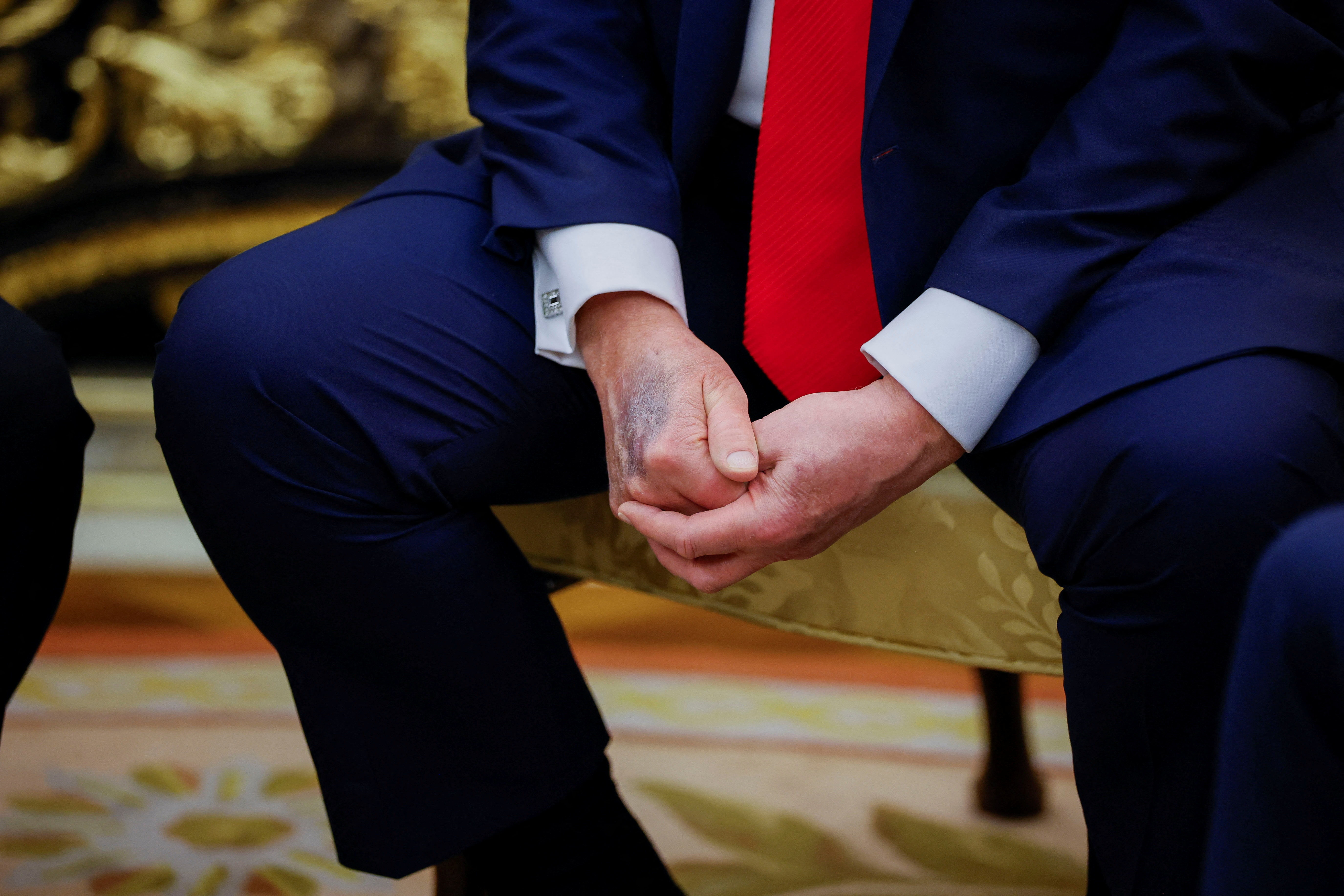 ▲▼美國總統川普25日在白宮接見南韓總統李在明，手背上的印記再次成為關注焦點。（圖／路透）