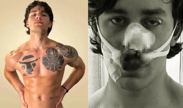 目睹2女電車上被攻擊　男模英勇救人「帥臉被刀砍15公分」毀容。（合成圖／翻攝自Instagram與GoFundMe）