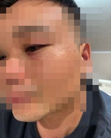 中國人不打中國人？媽媽訂4000元蒸螃蟹送錯家　鄰居收到吃光被拖行爆打
