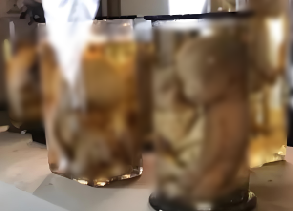 ▲731部隊做活體實驗。（圖／翻攝自微博）