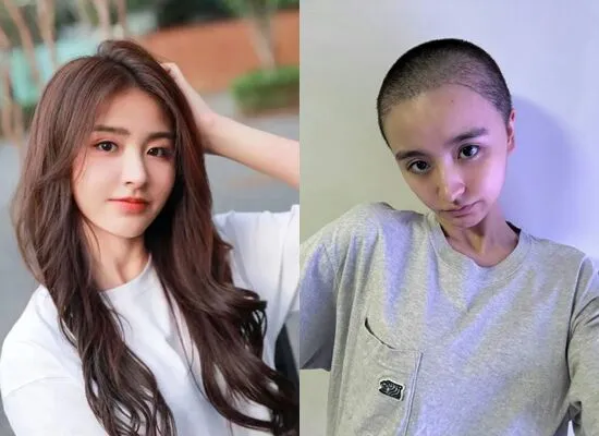 ▲金子涵剃光頭。（圖／翻攝自微博）