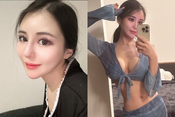 ▲▼24歲櫻花妹赴韓整形！「鼻樑化膿感染」無人管　醜到3個月不敢出門。（圖／Instagram）