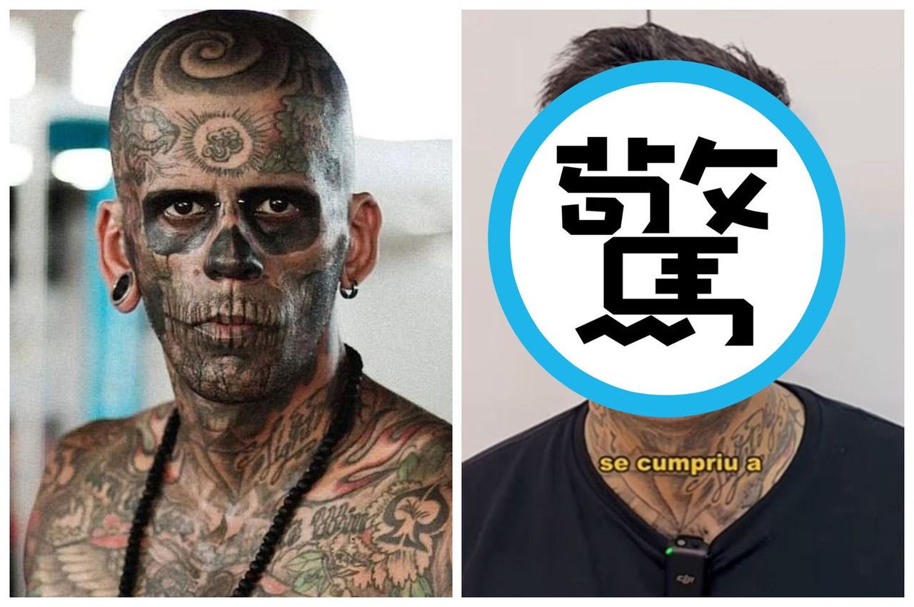「95%全身刺青」後悔了!男手術洗掉 曝痛苦過程:痛3倍