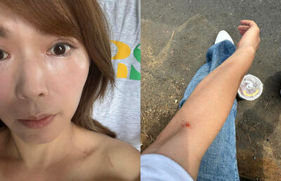 走讀受傷!陳智菡PO抓痕 撂「要辦就來」:爬拒馬非我們所選擇的