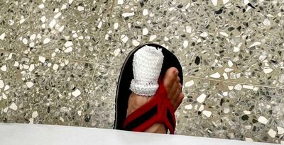 罕見!台南歸仁黃昏市場老鼠咬傷人 苦主:下次會穿布鞋去