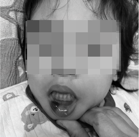 超扯!台東特教師狠虐6幼童「全身是瘀青」 校長調職加給照領