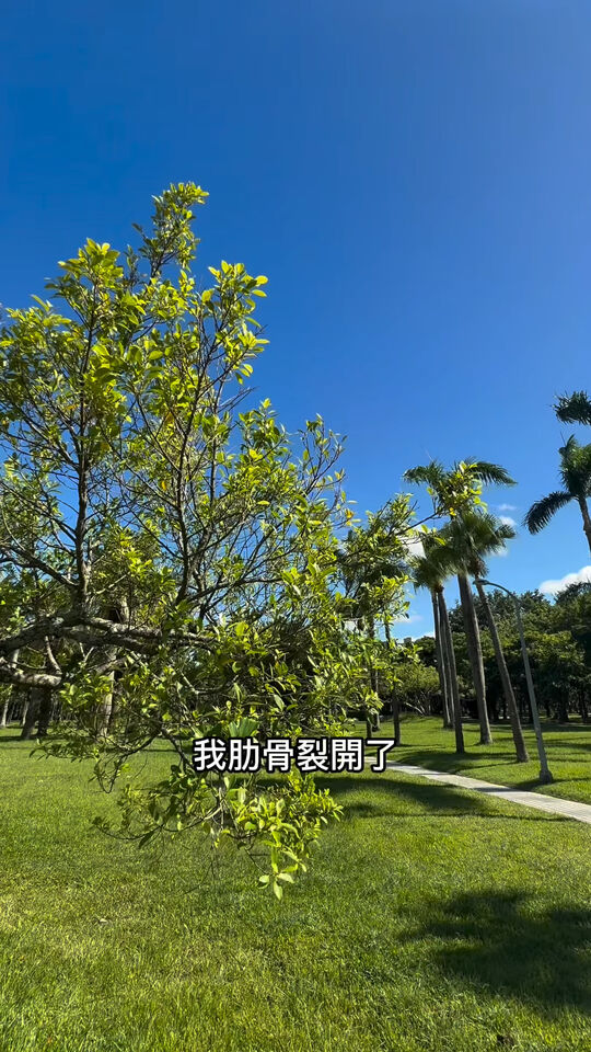 ▲▼劉書宏骨裂。（圖／翻攝自Instagram／kingkevinliu）