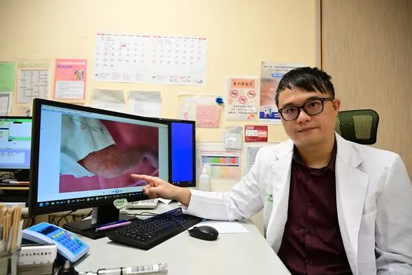 ▲▼醫師提醒罕病兒童家長莫心慌，只要遵循醫師建議治療，也能陪伴孩子長大成人。（圖／亞大醫院提供）