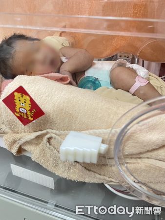 ▲▼出生21天的女嬰感染RSV狂咳嘔吐，醫師賴永清表示，傳染力強無特效藥。（圖／烏日林新醫院提供，下同）