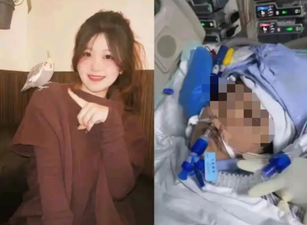 ▲小盧做完微創手術後身亡。（圖／翻攝自微博）