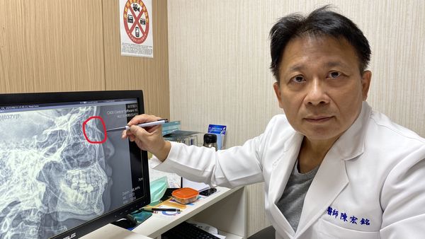 ▲▼二歲小孩往媽媽懷裡一撲，竟將媽媽鼻骨撞斷(紅圈處)，經員榮醫院整型外科主任陳宏銘主任手術矯正。（圖／員榮醫院提供）