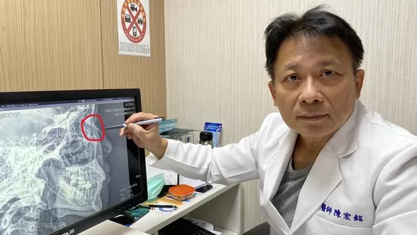 ▲▼二歲小孩往媽媽懷裡一撲，竟將媽媽鼻骨撞斷(紅圈處)，經員榮醫院整型外科主任陳宏銘主任手術矯正。（圖／員榮醫院提供）