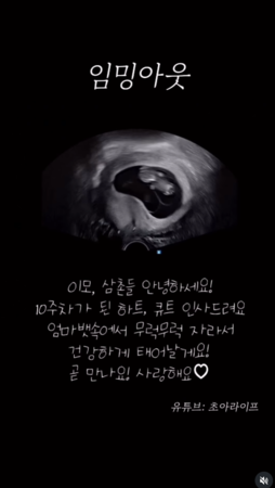 ▲▼CHOA。（圖／翻攝自Instagram／minjinchoa）