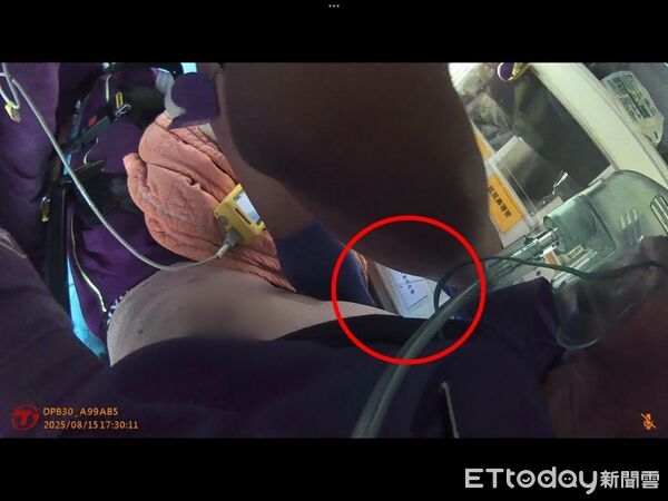 ▲生死一瞬間！台中男鋸木摔落「肺險爆」，救護員一針洩氣逆轉死神 。（圖／台中市消防局提供）