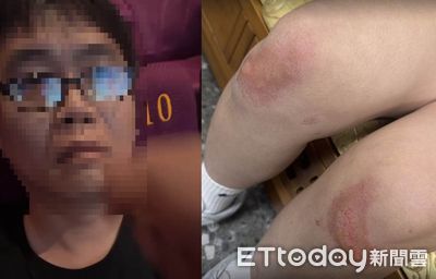 女兒看電影遭暴力男打到腦震盪！父怒譙「有夠夭壽」批影城消極