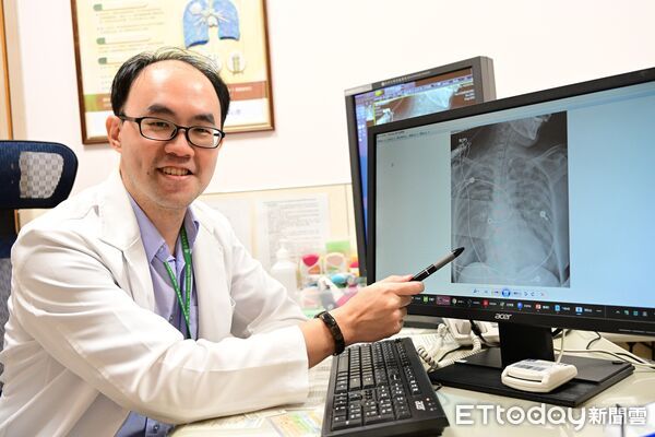 ▲七月撞邪「靈魂出竅」？醫：比鬼更猛的「隱形殺手」　65歲婦雙肺全白險喪命。（圖／亞大附醫提供）