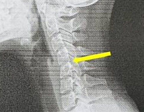 ▲▼天天滑手機。（圖／員榮醫院提供）