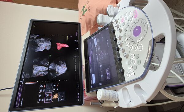 ▲▼「子宮內膜癌特別門診」提供高風險族群快速掛號  即時檢查服務。（圖／北市聯醫婦幼院區提供）