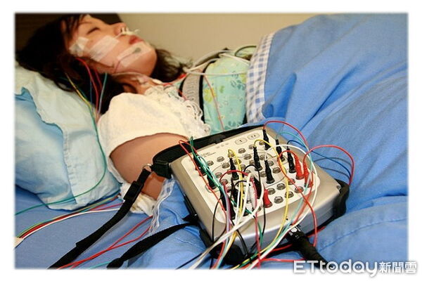 ▲▼費玉清《晚安曲》變助眠歌，楊建銘表示，慢節奏節卻有助於入眠。圖為夜間睡眠檢查。（圖／楊建銘提供）