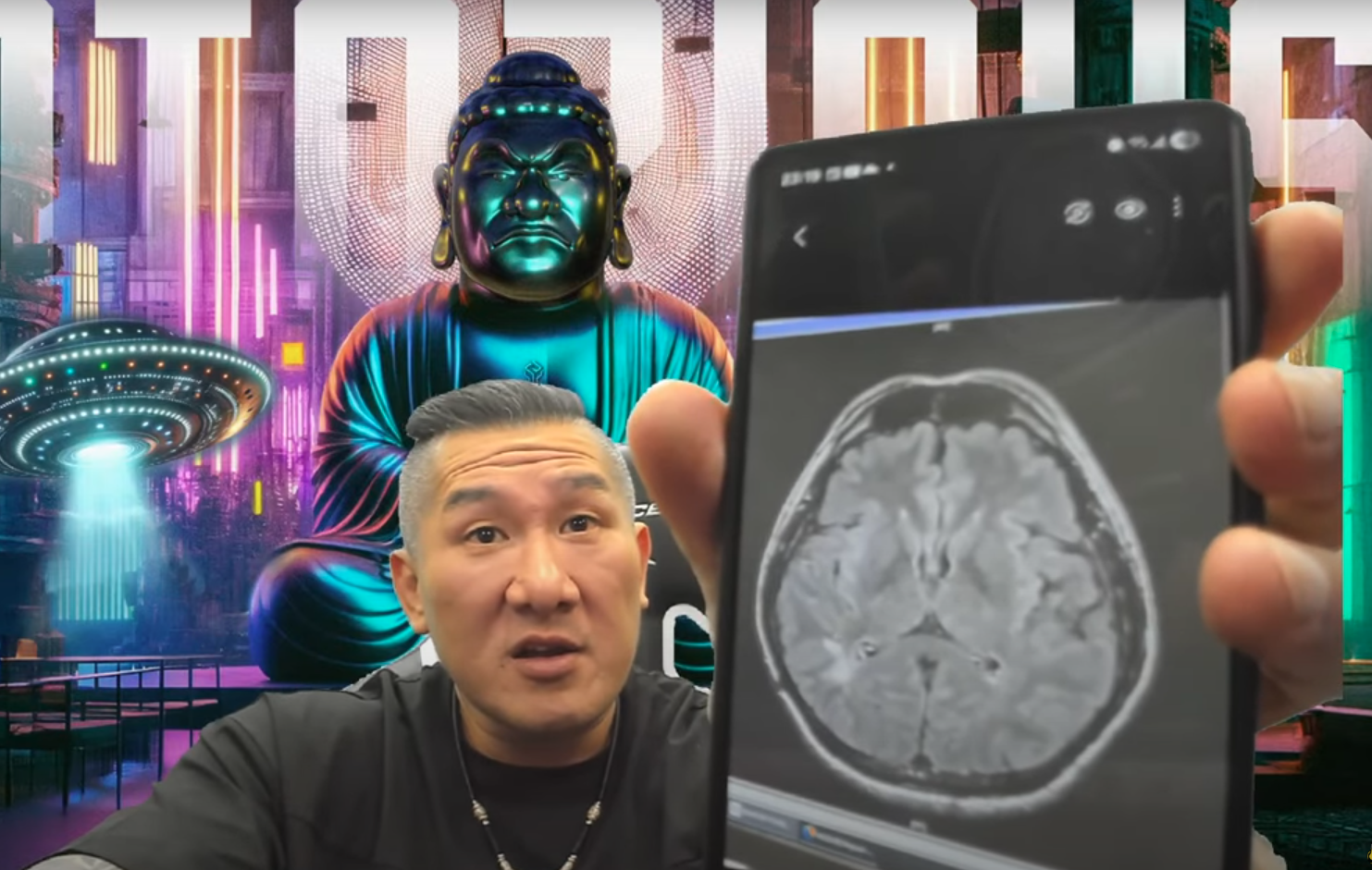 ▲館長在直播中秀出X光片，顯示部分血管「不見了」。（圖／翻攝自YouTube／館長惡名昭彰）