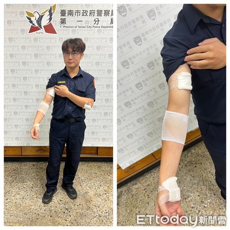 ▲台南市警一分局德高所長林海平在圍捕過程中右手臂被嫌犯咬傷，所幸送醫治療後無大礙。（圖／記者林東良翻攝，下同）