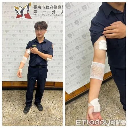▲台南市警一分局德高所長林海平在圍捕過程中右手臂被嫌犯咬傷，所幸送醫治療後無大礙。（圖／記者林東良翻攝，下同）