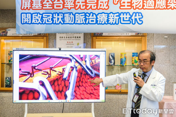 ▲屏基率先全台完成植入冠狀動脈生物適應架。（圖／屏基提供）
