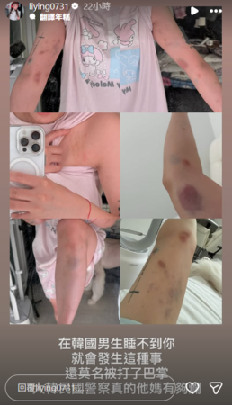 ▲▼劉力穎被打。（圖／翻攝自Instagram／liying0731）