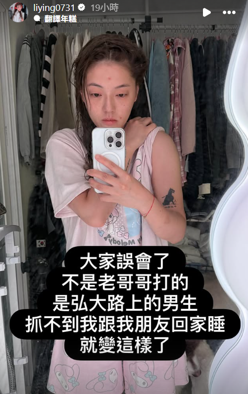 ▲▼劉力穎被打。（圖／翻攝自Instagram／liying0731）