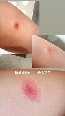 激瘦亮紅燈／獨家！半夜起床顧失聰老狗　王瞳長期睡3小時慘瘦