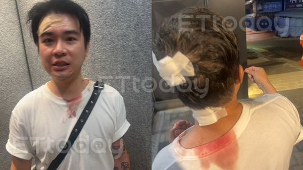 ▲香港直播主Ted遭到攻擊，滿臉鮮血             。（圖／記者吳奕靖翻攝）