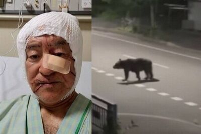 頭皮被撕裂、耳垂被咬斷！日男遇熊襲「滿臉鮮血」縫60針倖存