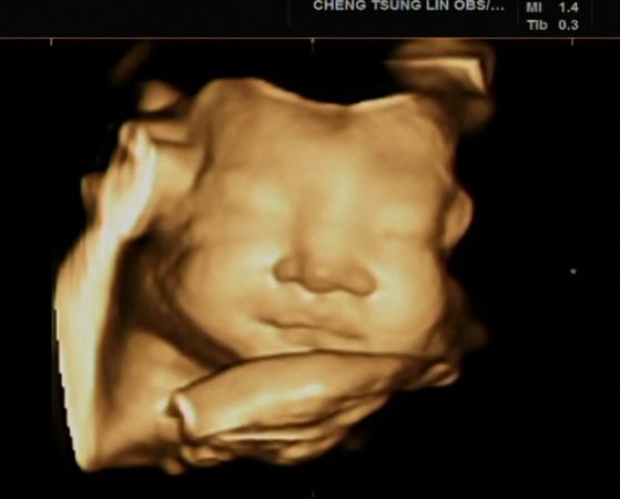 ▲▼洪詩二寶「首次露正臉」超音波照曝光　網：她在笑耶！（圖／翻攝自Instagram／angelhong）