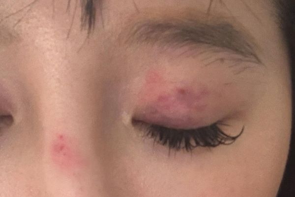 ▲▼台女倫敦遭圍毆獲提早做筆錄　警方坦言初步反應欠佳。（圖／原PO授權引用）