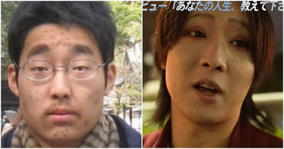 內向痘疤男曾被女生霸凌 如今變花美男Coser