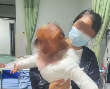知名品牌養生壺爆炸！　一歲孩童全身40％大面積燙傷