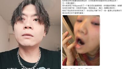 Ryu拍片自責說謊失信! 女畫家「曝傷照」控訴遭毆打:耳鳴3個月