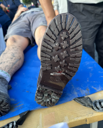 ▲ 玻璃刺穿民眾穿著的厚底防滑鞋，隔著鞋子還是可以看到傷口滲出血液。（圖／翻攝自花蓮慈院臉書）