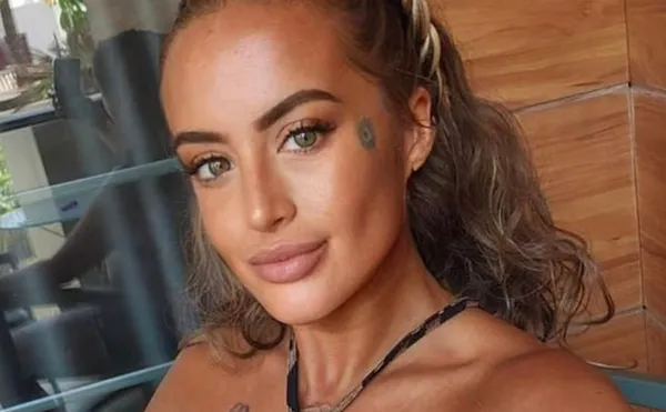 女和2寵物犬搶奪雞塊　被護食羅威那犬「一口咬斷動脈」失血亡。（圖／翻攝自募款網站GoFundMe）