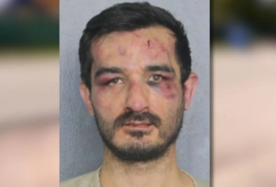 男凌晨闖民宅「屋主是MMA拳手」　被徒手痛扁滿臉瘀青囚照曝