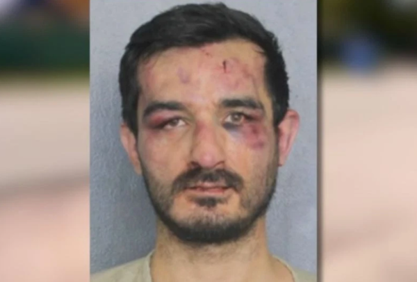 男凌晨闖進民宅「屋主是MMA選手」　被徒手痛扁滿臉瘀青囚照曝。（圖／翻攝自Broward County Sheriff`s Office）