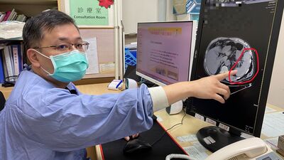 男子車禍無外傷兩天後才就醫 一查「脾臟破裂」險喪命