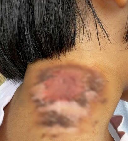 ▲河南隱翅蟲大量出沒。（圖／翻攝極目新聞）