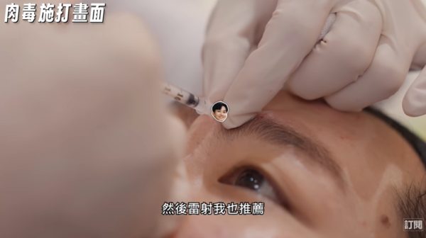 ▲▼Joeman「做8項醫美大改造」公開心得！男生最推這2項。（圖／翻攝自YouTube／Joeman）