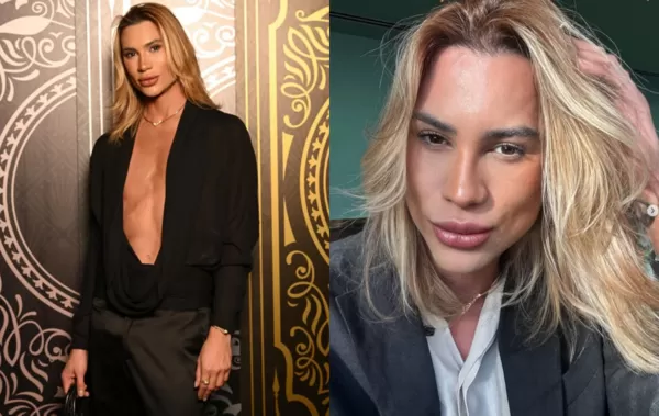 ▲▼ 巴西時尚網紅動刀「狐狸眼（fox eyes）」整形後死亡。（圖／翻攝自Instagram）