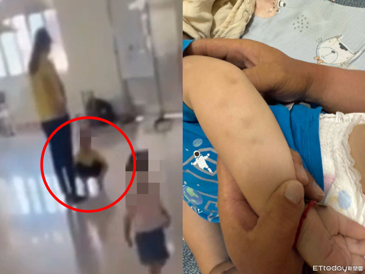 高雄林園3幼兒園虐童！增1教保員「打屁股、胸口」　累計6人停職