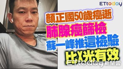 顏正國50歲肺腺癌逝!蘇一峰推這檢驗比X光更有用